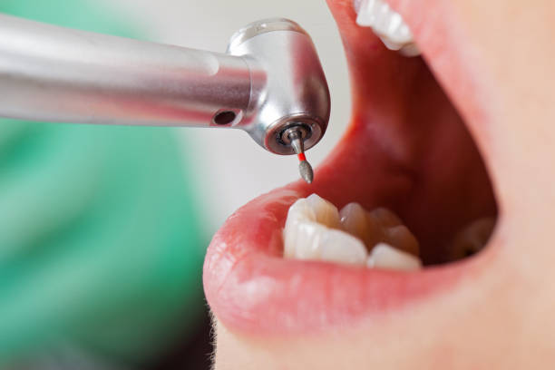 Best Chipped Tooth Repair Near Me  in Walkersville, MD